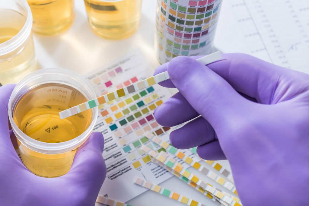 urinalysis